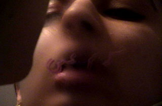 MNOYL thumbnail